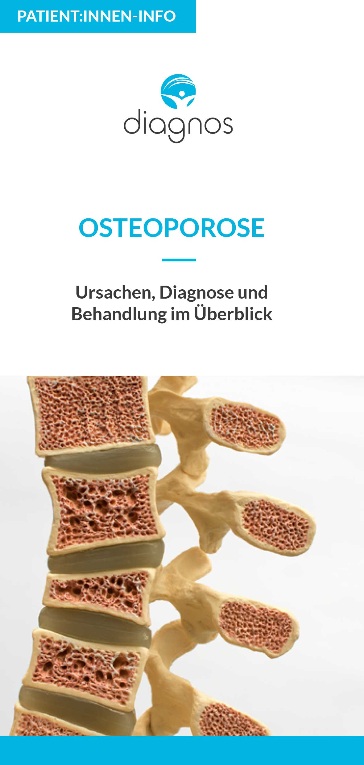 Osteoporose